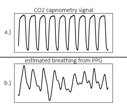 _images/CO2_RRbreath.jpg